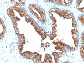 Monoclonal Mouse anti-Human Cytokeratin 8+18 Antibody (clone KRT8.18/1346, IHC, IF, WB)