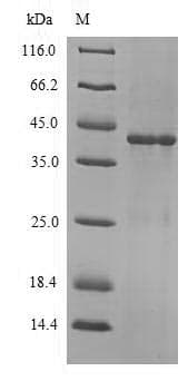 Pseudomonas aeruginosa Beta-lactamase OXA-10 Protein (Recombinant 6His-SUMO, N-terminus)