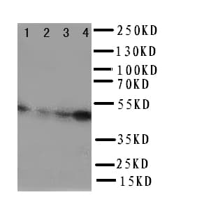AURKA / Aurora-A Antibody (aa109-125)