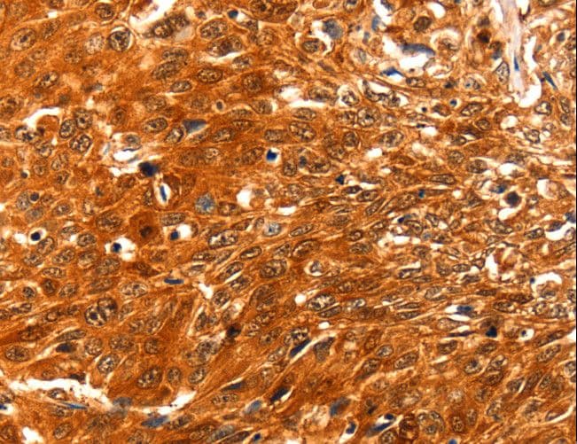 SERPINB5 / Maspin Antibody
