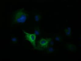 DNM1L / DRP1 Antibody (clone OTI3F4)