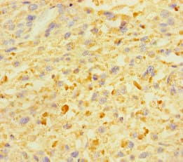 ZSCAN29 Antibody