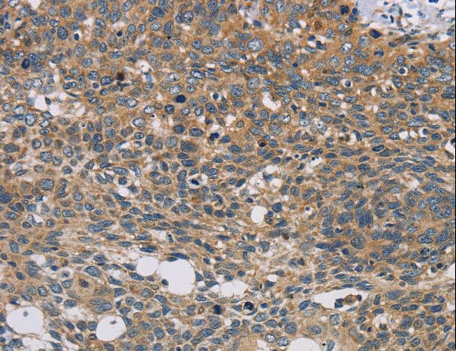 Polyclonal Rabbit anti-Human STAT4 Antibody (IHC)