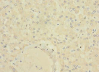 SLC22A9 / OAT7 Antibody