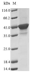 Dictyostelium discoideum dnapkcs Protein (Recombinant 10His, N-terminus + Myc, C-terminus)