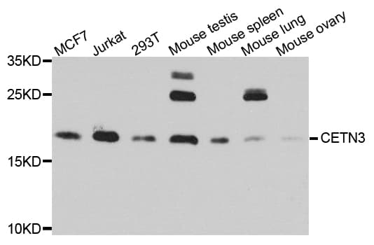 Polyclonal Rabbit anti-Human CETN3 Antibody (IHC, WB)