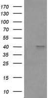 FCGR1A / CD64 Antibody (clone OTI1A9)