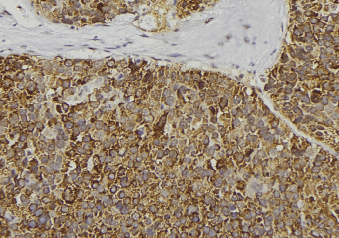CPB / Carboxypeptidase B Antibody