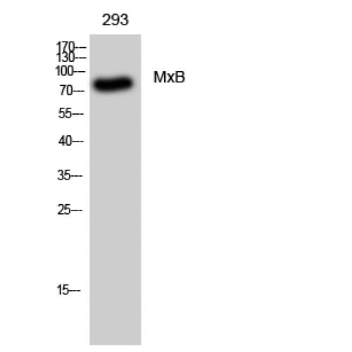 Polyclonal Rabbit anti-Human MX2 Antibody (Internal, WB)