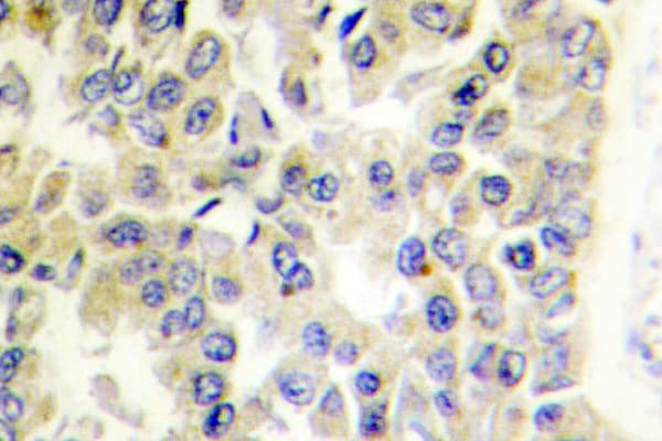 Polyclonal Rabbit anti-Human MARK1+2+3+4 Antibody (Asn211, IHC, IF, WB)