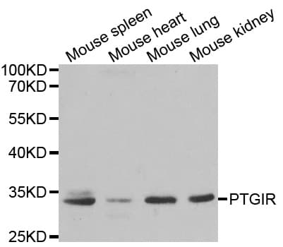 PTGIR / IP Receptor Antibody