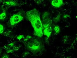 GFAP Antibody (clone OTI2C4)