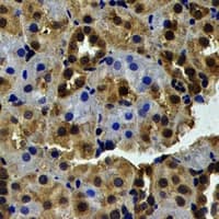WBSCR22 Antibody