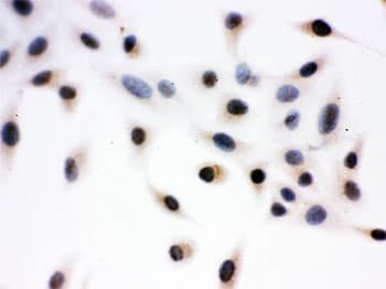 DAXX Antibody