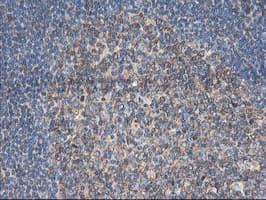 TUBAL3 Antibody (clone OTI1C2)