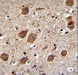 KCTD8 Antibody (aa434-462)
