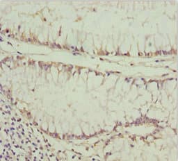 PRLTS / PDGFRL Antibody