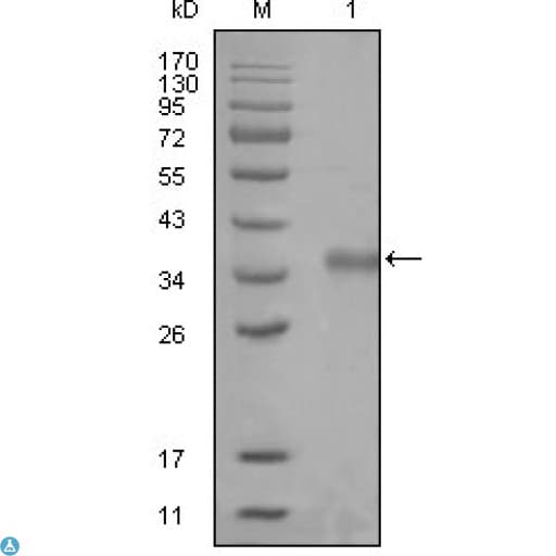 N-CoR / NCOR1 Antibody