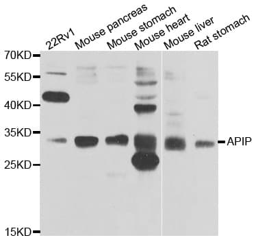 APIP Antibody (AP)