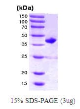 Human RAC2 Protein (Recombinant)