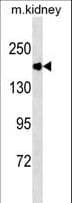 PathPlus™ ACE / CD143 Antibody (aa1274-1306)