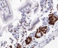 MKI67 / Ki67 Antibody (Internal)