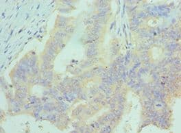 CCL28 / MEC Antibody (aa20-127)