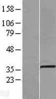 Human SLC25A3 Protein (Over-Expression Lysate Myc-DDK (Flag))
