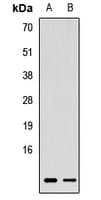RBX1 / ROC1 Antibody