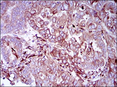 SYCP3 / SCP3 Antibody (aa27-128, clone 6F9B6)