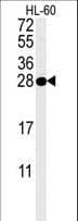 PSME1 Antibody (aa220-249)