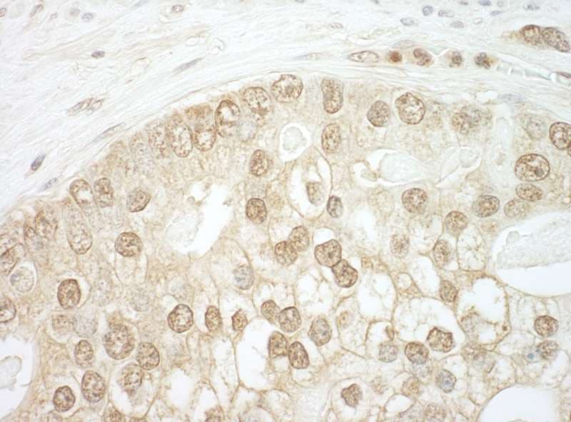 CNOT2 Antibody (aa490-540)