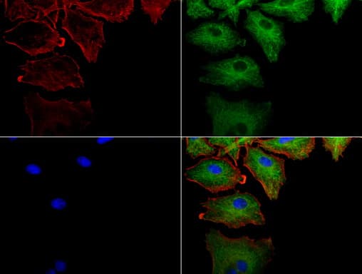KRT18 / CK18 / Cytokeratin 18 Antibody (aa69-372, clone UMAB50)