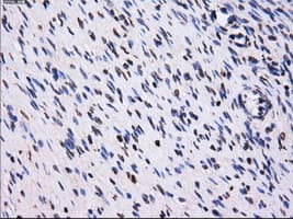 PME-1 / PPME1 Antibody (clone OTI2C5)