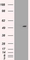 SERPINA1 / Alpha 1 Antitrypsin Antibody (clone OTI8E3)