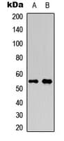 AML1 / RUNX1 Antibody (phospho-Ser276)