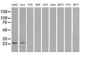 NEUROG1 / NGN1 / Neurogenin 1 Antibody (clone OTI9A8)