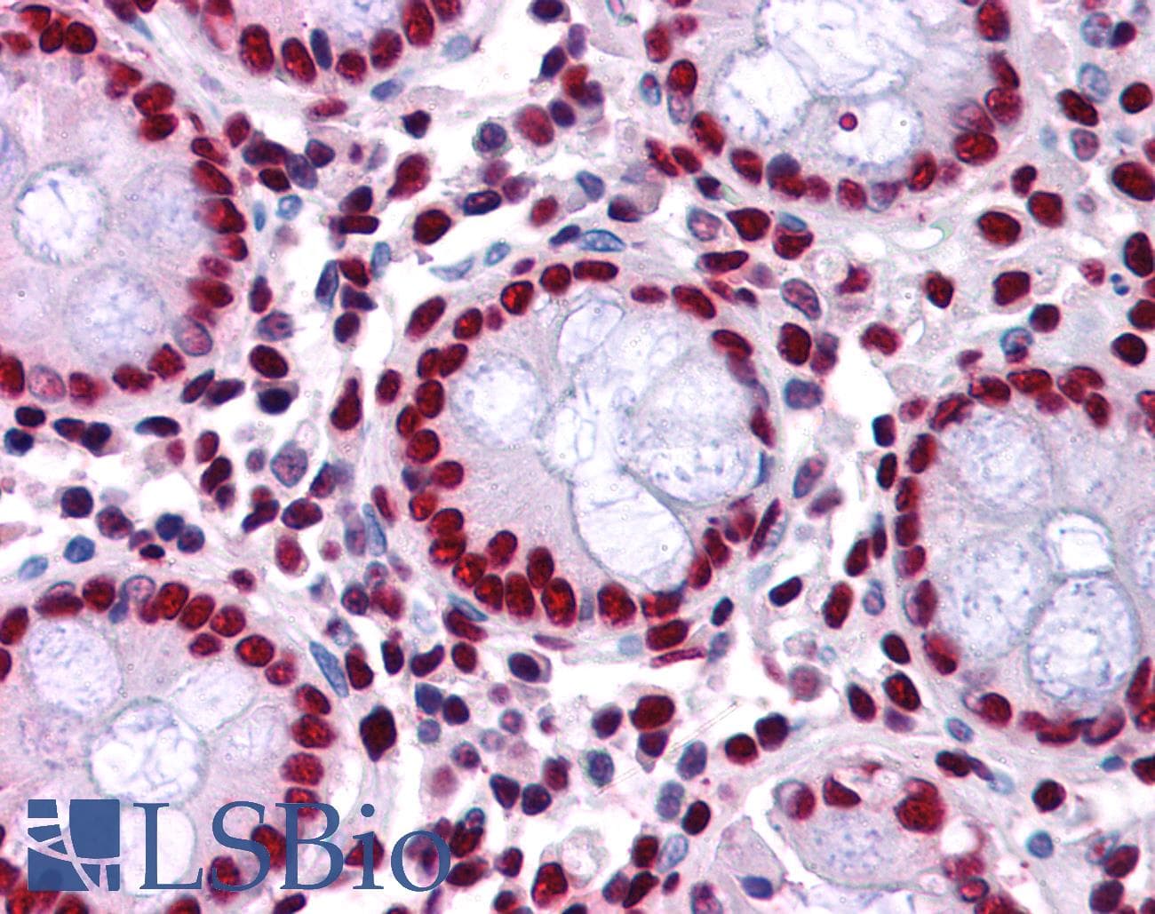 IHC-plus™ Polyclonal Goat anti-Human TRIM28 / KAP1 Antibody (aa823-835, IHC, IF)