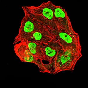 ER Alpha / Estrogen Receptor Antibody (clone 6A6F3)