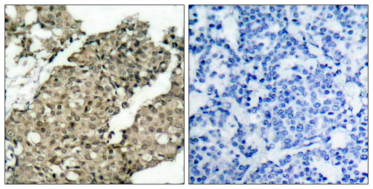 G3BP1 / G3BP Antibody (phospho-Ser232)