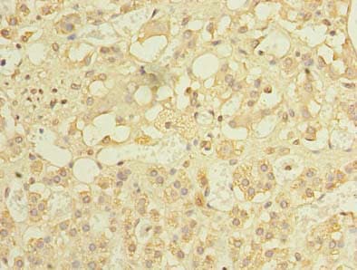 Polyclonal Rabbit anti-Human MCM9 Antibody (IHC, WB)