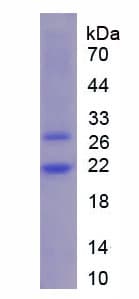 Mouse CSF3R / CD114 Protein (Recombinant His)