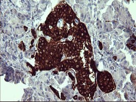 SYP / Synaptophysin Antibody (clone OTI3E2, Carrier-free)