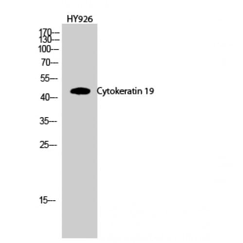 KRT19 / CK19 / Cytokeratin 19 Antibody (200-280 aa, Internal)