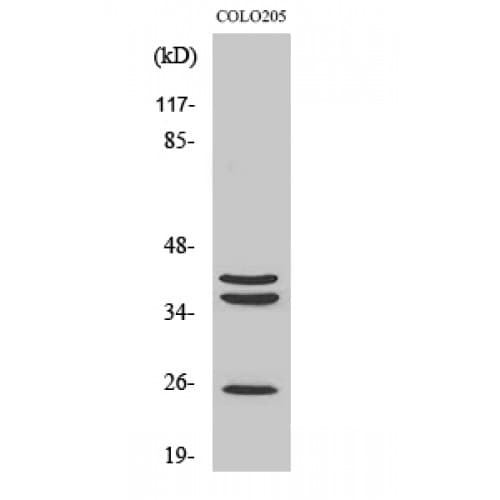 CTSB / Cathepsin B Antibody (Internal)