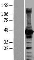 p21-ARC / ARPC3 Protein (Over-Expression Lysate Myc-DDK (Flag))