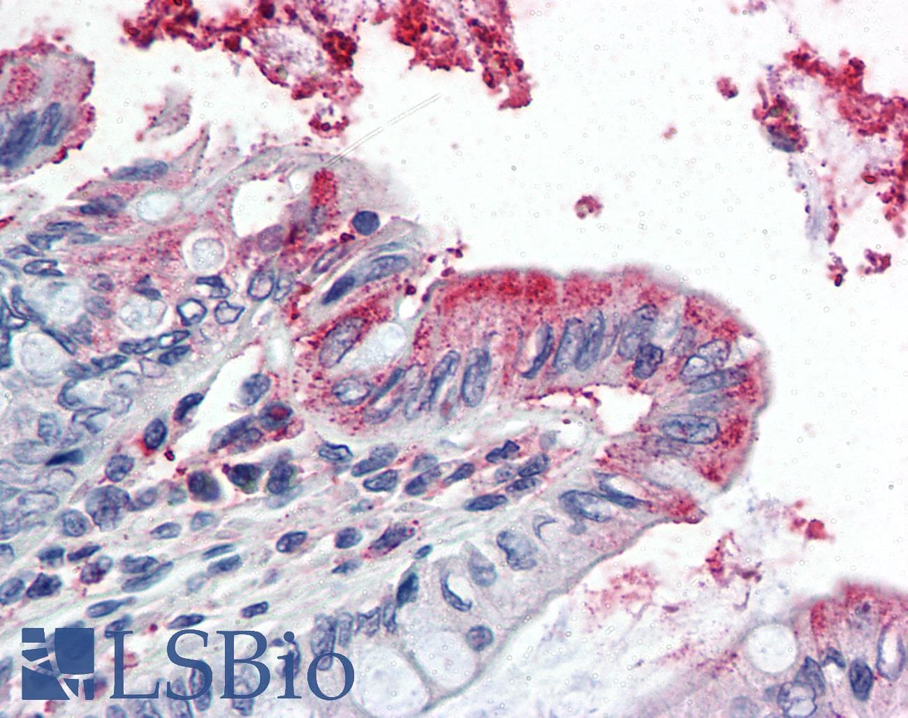 IHC-plus™ GPX3 Antibody (aa102-114)