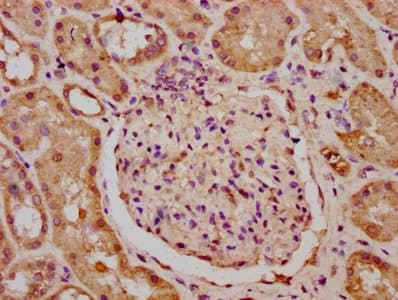 Polyclonal Rabbit anti-Human KIF23 / MKLP1 Antibody (IHC)