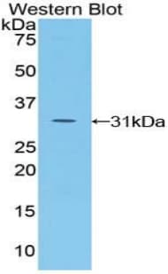 KPNA2 / Importin Alpha 1 Antibody (aa157-412, HRP)