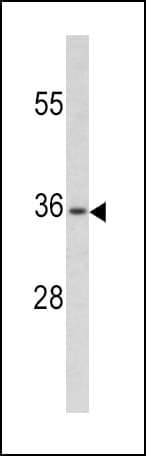 Polyclonal Rabbit anti-Human PAX4 Antibody (aa171-200, IHC, WB)